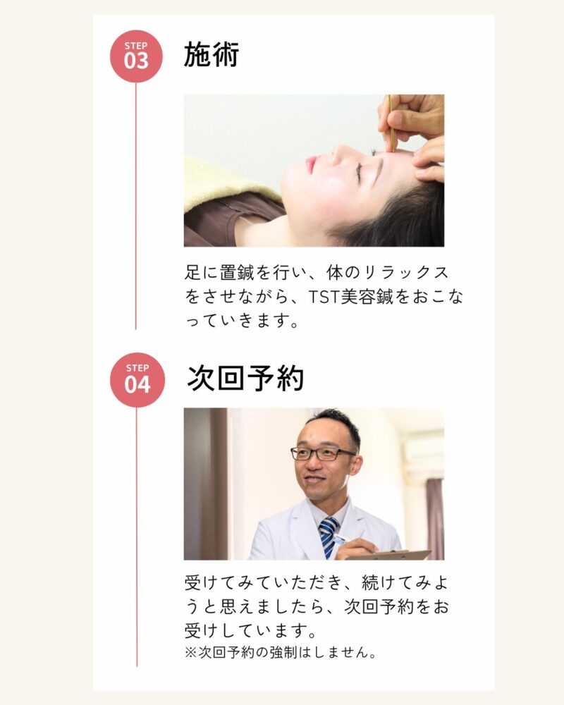 施術
足に置鍼を行い、体のリラックスをさせながら、TST美容鍼をおこなっていきます。
次回予約
受けてみていただき、続けてみようと思えましたら、次回予約をお受けしています。
※次回予約の強制はしません。