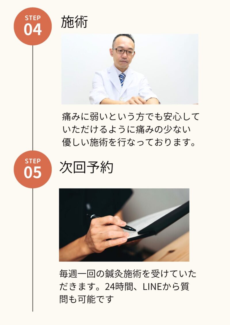 Step5　施術
痛みに弱いという方でも安心していただけるように痛みの少ない
優しい施術を行なっております。
Step5　次回予約
毎週一回の鍼灸施術を受けていただきます。24時間、LINEから質問も可能です