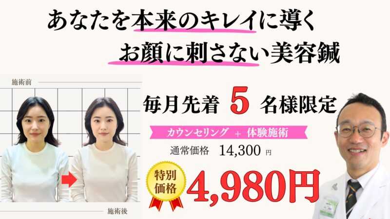あなたを本r内のキレイに導くお顔に刺さない美容鍼。毎月限定5名様 初回特別価格14300円⇒4980円